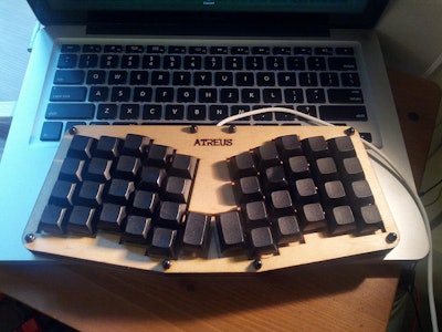 Atreus Keyboard Kit