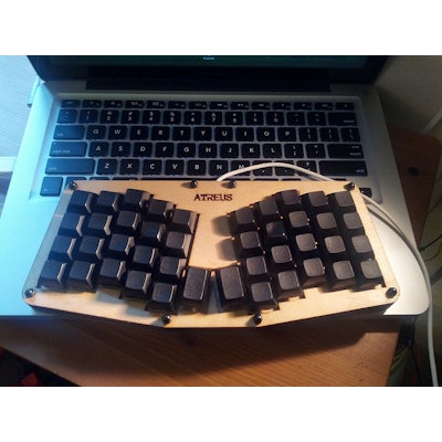 Atreus Keyboard Kit