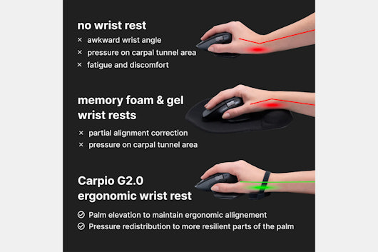 DeltaHub Carpio G2.0 Wrist Rest RandomFrankP Edition